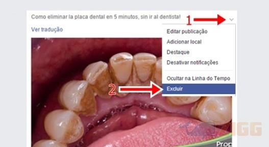 Como remover o Spam da placa dental do Facebook